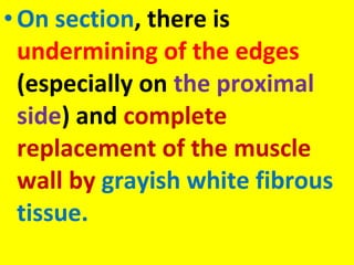 • On section, there is
undermining of the edges
(especially on the proximal
side) and complete
replacement of the muscle
wall by grayish white fibrous
tissue.

 