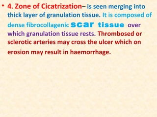 • 4. Zone of Cicatrization– is seen merging into

thick layer of granulation tissue. It is composed of
dense fibrocollagenic scar tissue over
which granulation tissue rests. Thrombosed or
sclerotic arteries may cross the ulcer which on
erosion may result in haemorrhage.

 