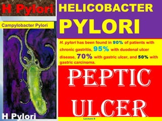 H Pylori HELICOBACTER
Campylobacter Pylori

PYLORI

H. pylori has been found in 90% of patients with
chronic gastritis, 95% with duodenal ulcer

disease, 70% with gastric ulcer, and 50% with
gastric carcinoma.

H Pylori

PePtic
ulcer
Lecture 8

 