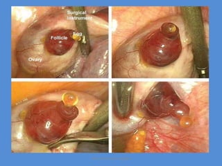 Maryam Borhani-Haghighi
 
