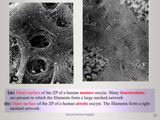 Maryam Borhani-Haghighi
37
(a): Outer surface of the ZP of a human mature oocyte. Many fenestrations
are present in which the filaments form a large meshed network
(b): Outer surface of the ZP of a human atretic oocyte. The filaments form a tight
meshed network.
 
