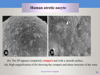 Maryam Borhani-Haghighi
38
(b): The ZP appears completely compact and with a smooth surface.
(d): High magnification of (b) showing the compact and dense structure of the zona.
Human atretic oocyte
 