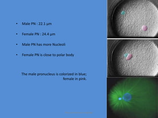 • Male PN : 22.1 µm
• Female PN : 24.4 µm
• Male PN has more Nucleoli
• Female PN is close to polar body
The male pronucleus is colorized in blue;
female in pink.
Maryam Borhani-Haghighi
 