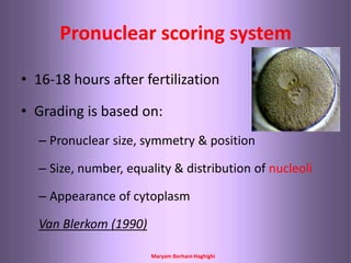 Maryam Borhani-Haghighi
Pronuclear scoring system
• 16-18 hours after fertilization
• Grading is based on:
– Pronuclear size, symmetry & position
– Size, number, equality & distribution of nucleoli
– Appearance of cytoplasm
Van Blerkom (1990)
 