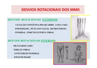 DESVIOS ROTACIONAIS DOS MMII
DESVIOS ROTACIONAIS EXTERNOS
LUXAÇÃO CONGÊNITA DOS QUADRIS, COXA VARA
EPIFISIÓLISE, PÉ PLANO VALGO, RETROVERSÃO
FEMORAL, TORÇÃO EXTERNA TIBIAL
DESVIOS ROTACIONAIS INTERNOS
METATARSO VARO
TORÇÃO TIBIAL
ANTEVERSÃO FEMORAL
ESPASTICIDADE
 