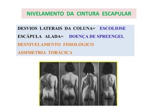 NIVELAMENTO DA CINTURA ESCAPULAR
DESVIOS LATERAIS DA COLUNA= ESCOLIOSE
ESCÁPULA ALADA= DOENÇA DE SPREENGEL
DESNIVELAMENTO FISIOLÓGICO
ASSIMETRIA TORÁCICA
 