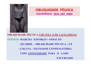 OBLIQUIDADE PÉLVICA
DISCREPÂNCIA REAL DOS MMII
CAUSAS- IDIOPÁTICAS, FRATURAS,INFECÇÃO , ETC.
OBLIQUIDADE PÉLVICA NÃO FIXA E DE CAUSA DISTAL
EFEITOS- MARCHA –ESFORÇO > IMPACTO
- QUADRIL – OBLIQUIDADE PÉLVICA < CE
- COLUNA – ESCOLIOSE CONPENSATÓRIA
COM CONVEXIDADE PARA O LADO
ENCURTADO
 