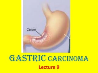 Gastric carcinoma
Lecture 9

 