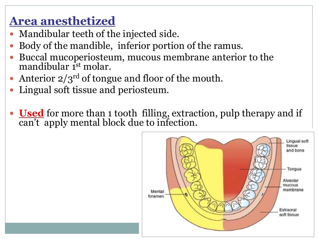 Local Anesthesia for pediatric dentistry