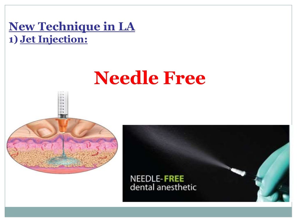 Local Anesthesia for pediatric dentistry