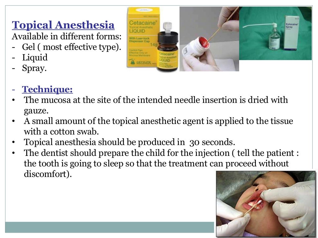 Local Anesthesia for pediatric dentistry
