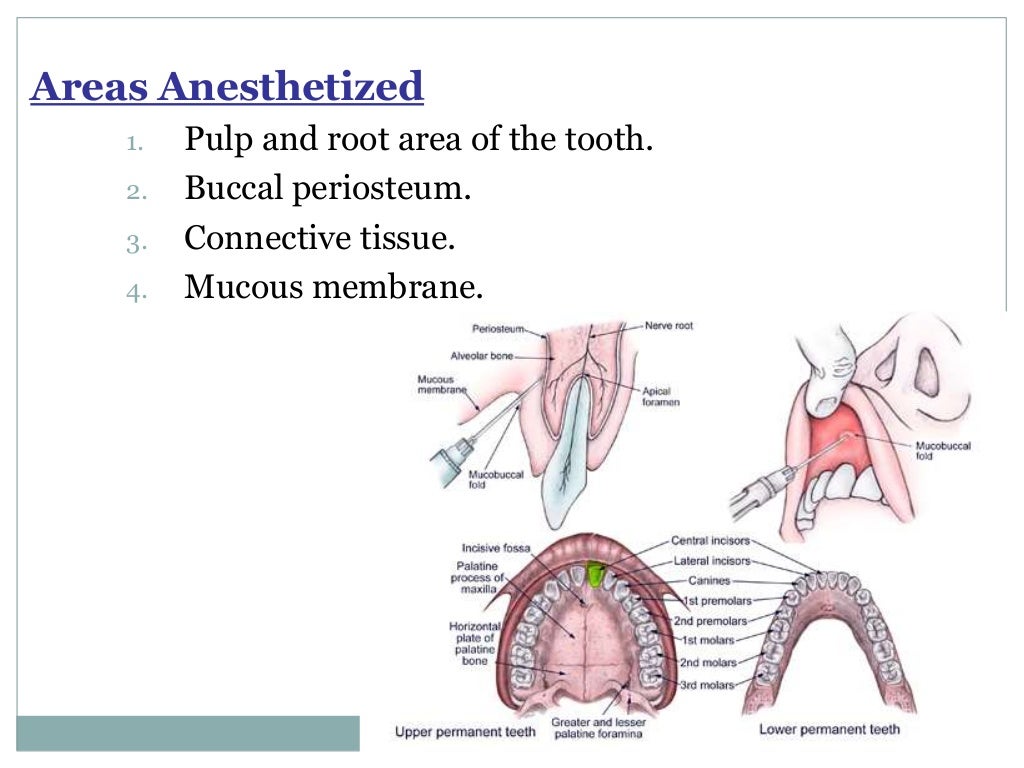 Local Anesthesia for pediatric dentistry