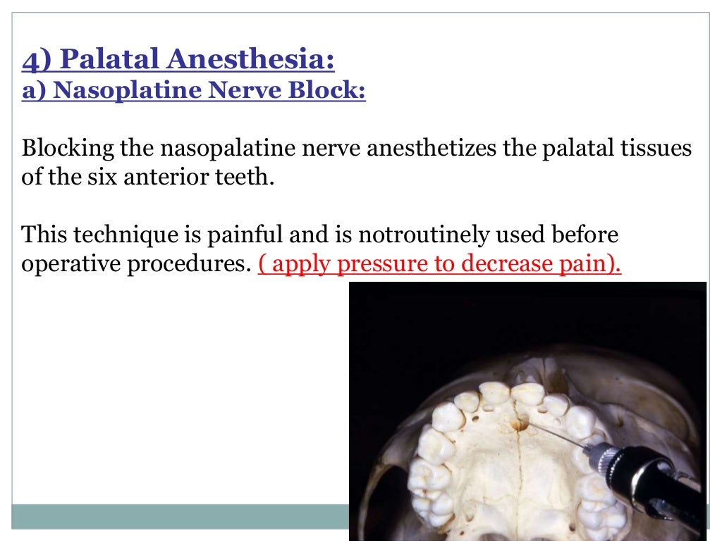 Local Anesthesia for pediatric dentistry