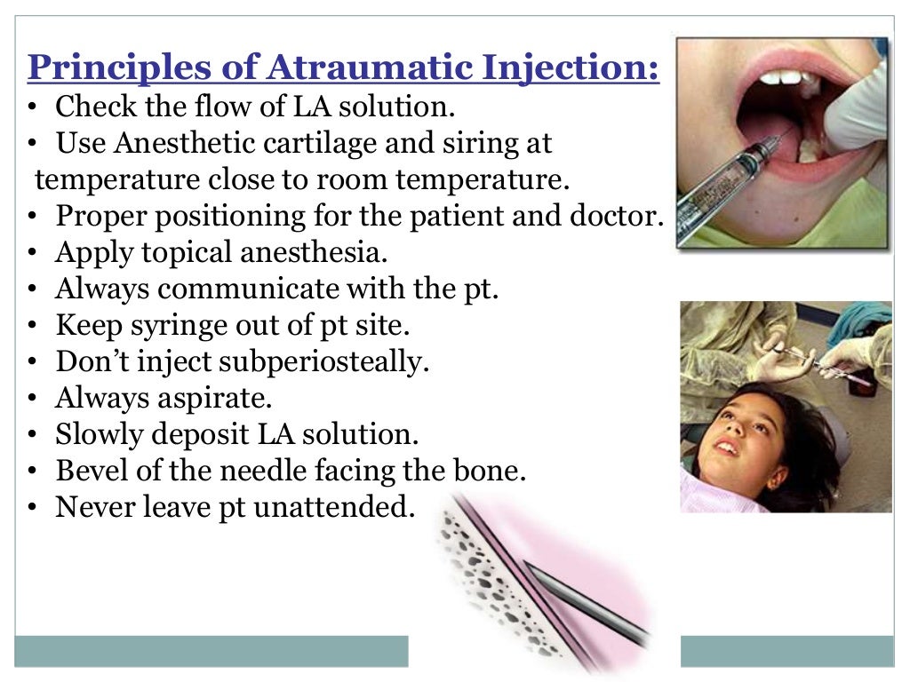 Local Anesthesia for pediatric dentistry
