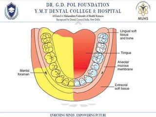 Local anesthesia powerpoint presentation.ppt