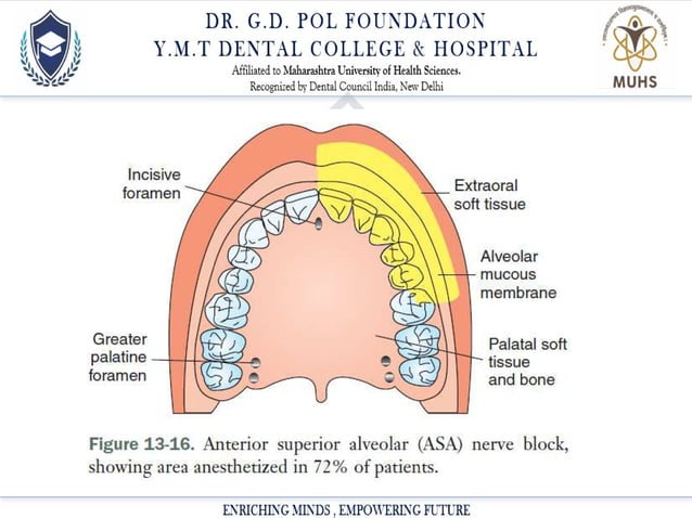 Local Anesthesia Powerpoint Presentation Ppt