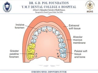 Local anesthesia powerpoint presentation.ppt