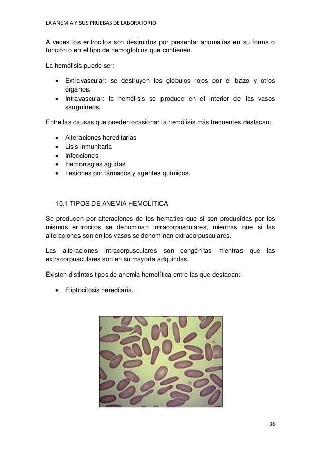 La anemia-y-sus-pruebas-de-laboratorio-pdf