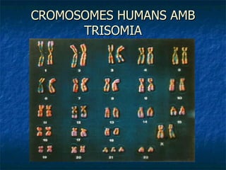 CROMOSOMES HUMANS AMB TRISOMIA 