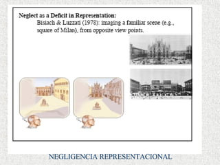 NEGLIGENCIA REPRESENTACIONAL 