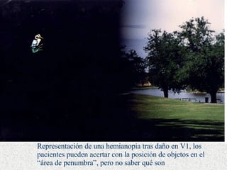 Representación de una hemianopia tras daño en V1, los pacientes pueden acertar con la posición de objetos en el “área de penumbra”, pero no saber qué son 