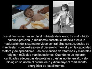 Los síntomas varían según el nutriente deficiente. La malnutrición calórico-proteica (o marasmo) durante la infancia afecta la maduración del sistema nervioso central. Sus consecuencias se manifiestan como retraso en el desarrollo mental y en la capacidad motora y de aprendizaje. Las deficiencias de vitaminas y minerales originan múltiples manifestaciones. Cuando no se ingieren cantidades adecuadas de proteínas o éstas no tienen alto valor biológico se altera el crecimiento y disminuye el rendimiento energético de los alimentos. 