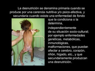 La desnutrición se denomina primaria cuando se produce por una carencia nutritiva y/o psico-afectiva, y secundaria cuando existe una enfermedad de fondo que la condiciona o la determina, independientemente  de su situación socio-cultural; por ejemplo enfermedades genéticas, metabólicas, inmunológicas, malformaciones, que puedan afectar a cerebro, corazón, riñón, hígado, etc., y que secundariamente produzcan una desnutrición.  