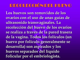 LA FECUNDACIÓN IN VITRO