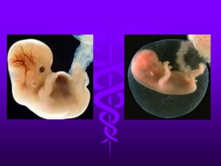 LA FECUNDACIÓN IN VITRO