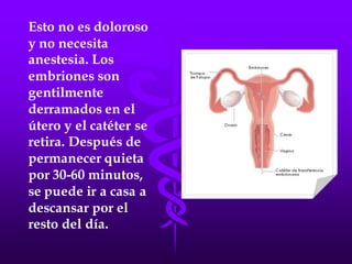 LA FECUNDACIÓN IN VITRO