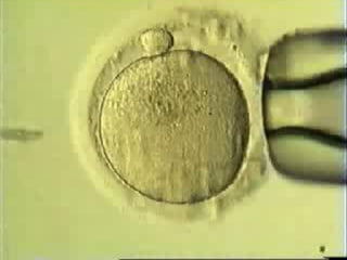 LA FECUNDACIÓN IN VITRO