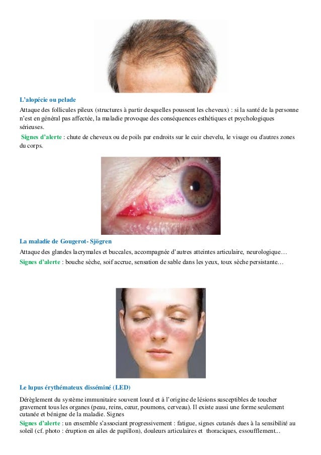Ladonno-podochvennyj le psoriasis le schéma du traitement