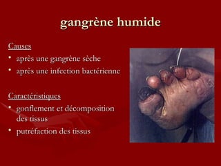 gangrène humide Causes après une gangrène sèche après une infection bactérienne Caractéristiques gonflement et décomposition des tissus putréfaction des tissus 