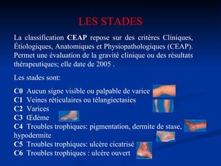 La classification  CEAP  repose sur des critères Cliniques, Étiologiques, Anatomiques et Physiopathologiques (CEAP). Permet une évaluation de la gravité clinique ou des résultats thérapeutiques; elle date de 2005 . Les stades sont: C0  Aucun signe visible ou palpable de varice C1  Veines réticulaires ou télangiectasies  C2  Varices  C3  Œdème C4  Troubles trophiques: pigmentation, dermite de stase, hypodermite C5  Troubles trophiques: ulcère cicatrisé C6  Troubles trophiques   : ulcère ouvert LES STADES 