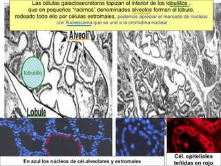Las células galactosecretoras tapizan el interior de los lobulillos ,
que en pequeños “racimos” denominados alveolos forman el lóbulo,
rodeado todo ello por células estromales, podemos apreciar el marcado de núcleos
con fluoresceina que se une a la cromatina nuclear
En azul los núcleos de cél.alveolares y estromales
Cél. epiteliales
teñidas en rojo
lobulillo
 