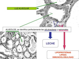 ALVEOLOS, se identifica perfectamente las cél.alveolares y estromales
LUZ ALVEOLAR
LECHE
LIPOPROTEÍNAS
LIPASA
INMUNOGLOBULINAS
 