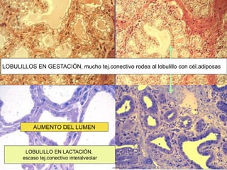 LOBULILLOS EN GESTACIÓN, mucho tej.conectivo rodea al lobulillo con cél.adiposas
LOBULILLO EN LACTACIÓN,
escaso tej.conectivo interalveolar
AUMENTO DEL LUMEN
 