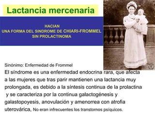 Lactancia mercenaria
Sinónimo: Enfermedad de Frommel
El síndrome es una enfermedad endocrina rara, que afecta
a las mujeres que tras parir mantienen una lactancia muy
prolongada, es debido a la síntesis continua de la prolactina
y se caracteriza por la continua galactogénesis y
galastopoyesis, anovulación y amenorrea con atrofia
uterovárica, No eran infrecuentes los transtornos psíquicos.
HACIAN
UNA FORMA DEL SINDROME DE CHIARI-FROMMEL
SIN PROLACTINOMA
 