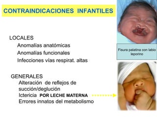 CONTRAINDICACIONES INFANTILES
LOCALES
Anomalías anatómicas
Anomalías funcionales
Infecciones vías respirat. altas
GENERALES
Alteración de reflejos de
succión/deglución
Ictericia POR LECHE MATERNA
Errores innatos del metabolismo
Fisura palatina con labio
leporino
 