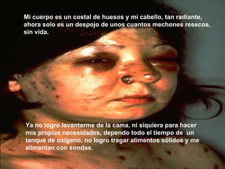 Mi cuerpo es un costal de huesos y mi cabello, tan radiante, ahora solo es un despojo de unos cuantos mechones resecos, sin vida. Ya no logro levantarme de la cama, ni siquiera para hacer mis propias necesidades, dependo todo el tiempo de  un tanque de oxígeno, no logro tragar alimentos sólidos y me  alimentan con sondas. 