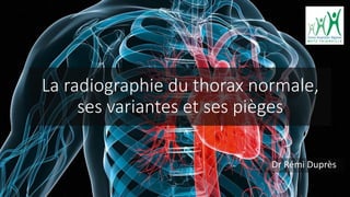 La radiographie du thorax normale,
ses variantes et ses pièges
Dr Rémi Duprès
 