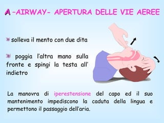 solleva il mento con due dita poggia l’altra mano sulla fronte e spingi la testa all’ indietro  A   –AIRWAY- APERTURA DELLE VIE AEREE La manovra di  iperestensione  del capo ed il suo mantenimento impediscono la caduta della lingua e permettono il passaggio dell’aria. 