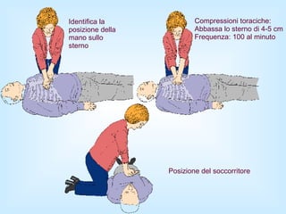 Posizione del soccorritore Identifica la  posizione della  mano sullo  sterno Compressioni toraciche: Abbassa lo sterno di 4-5 cm Frequenza: 100 al minuto 