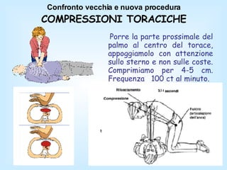 Confronto vecchia e nuova procedura COMPRESSIONI TORACICHE Porre la parte prossimale del palmo al centro del torace, appoggiamolo con attenzione sullo sterno e non sulle coste. Comprimiamo per 4-5 cm. Frequenza  100 ct al minuto. 