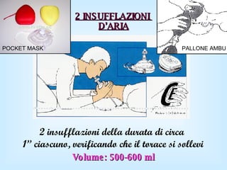 2 INSUFFLAZIONI  D’ARIA 2 insufflazioni della durata di circa  1” ciascuno, verificando che il torace si sollevi Volume: 500-600 ml PALLONE AMBU POCKET MASK 