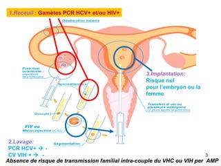 3.Implantation:
Risque nul
pour l’embryon ou la
femme
1.Receuil : Gamètes PCR HCV+ et/ou HIV+
Absence de risque de transmission familial intra-couple du VHC ou VIH per AMP
2.Lavage:
PCR HCV+  -
CV VIH + -
FIV ou
3
 