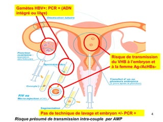 Risque de transmission
du VHB à l’embryon et
à la femme Ag-/AcHBs-
Gamètes HBV+: PCR + (ADN
intégré ou libre)
Risque présumé de transmission intra-couple per AMP
FIV ou
4Pas de technique de lavage et embryon +/- PCR +
 