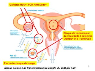 Risque de transmission
du virus Delta à la femme
AgHBs+ et à l’embryon
Gamètes HDV+: PCR ARN Delta+
Risque présumé de transmission intra-couple du VHD per AMP
FIV ou
5
Pas de technique de lavage
 