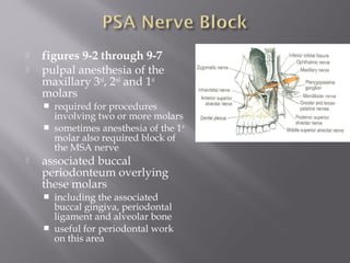  figures 9-2 through 9-7
 pulpal anesthesia of the
maxillary 3rd
, 2nd
and 1st
molars
 required for procedures
involving two or more molars
 sometimes anesthesia of the 1st
molar also required block of
the MSA nerve
 associated buccal
periodonteum overlying
these molars
 including the associated
buccal gingiva, periodontal
ligament and alveolar bone
 useful for periodontal work
on this area
 