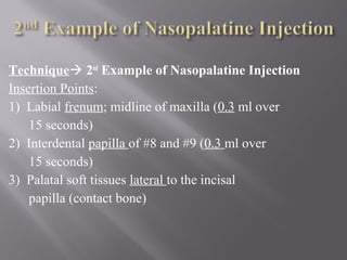 Technique 2nd
Example of Nasopalatine Injection
Insertion Points:
1) Labial frenum; midline of maxilla (0.3 ml over
15 seconds)
2) Interdental papilla of #8 and #9 (0.3 ml over
15 seconds)
3) Palatal soft tissues lateral to the incisal
papilla (contact bone)
 